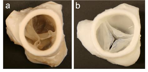 10 Expert Steps To Make Pro Pig Heart Valves