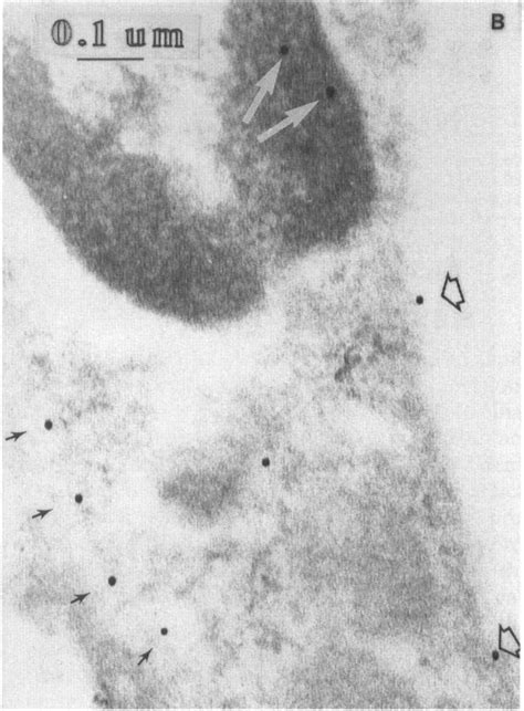 Capillary Profile From Developing Suckling Rabbit Brain Cortex Open Download Scientific