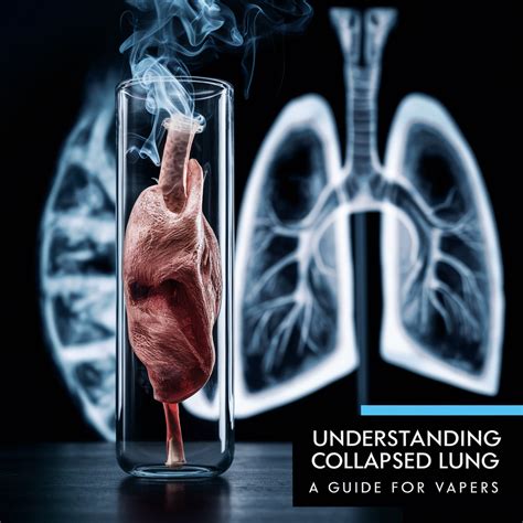 E-Book - Understanding Collapsed Lung: A Guide For Vapers [Exclusive 85% Off] | In Richmond ...