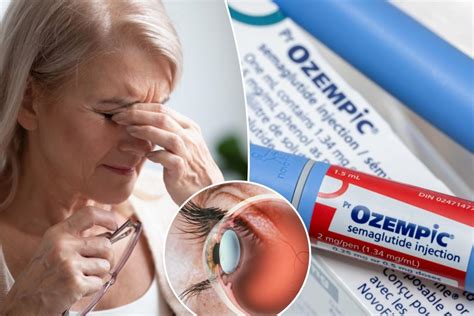 Ozempic Wegovy May Cause Serious Eye Condition Study Warns