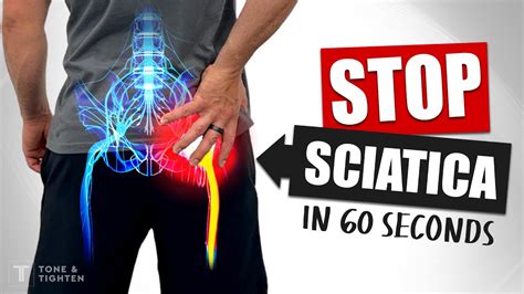 Severe Sciatic Nerve Leg Pain Relief Best Pain Relief For Sciatica