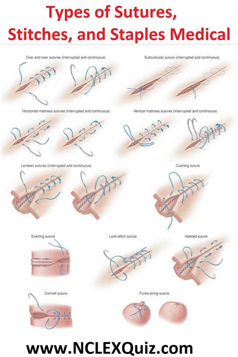 Surgical Suturing Medical Terminology