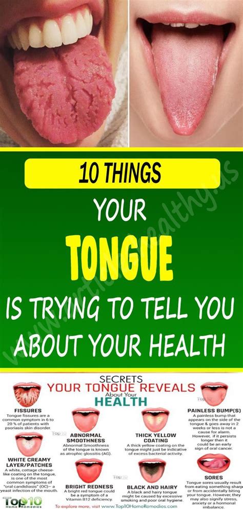 Ultimate Guide: 8 Easy Steps To Get Rid Of Tongue Dots